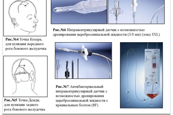 Кракен работает